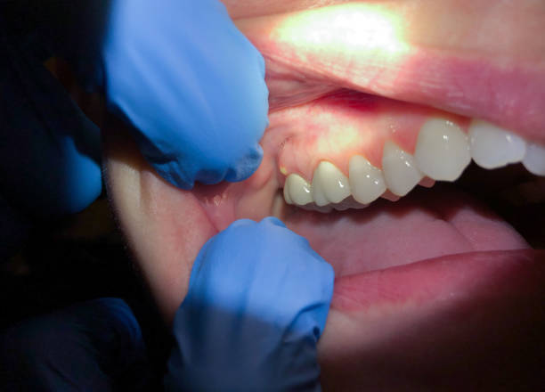 Best Weekend Emergency Dental Services in Glen Burnie, MD
